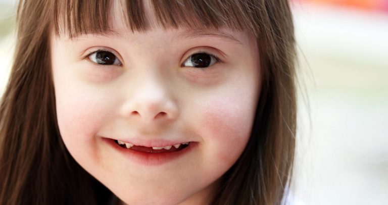 Descrição de Imagem: Fotografia do rosto de uma menina com Sindrome de Down. Ela é branca, com os cabelos castanhos lisos e está sorrindo.