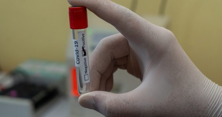 mão segurando um pequeno frasci transparente com uma etiqueta escrito: covid 19